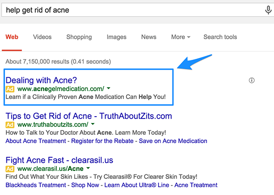 adwords-copy-get-rid-of-acne