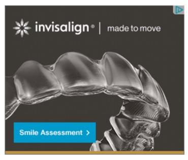 banner ad example from Invisalign