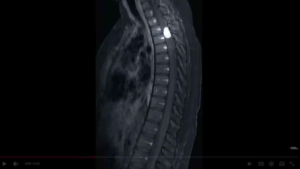 OTT advertising examples - healthcare ad